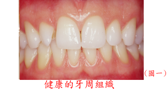 健康的牙周組織