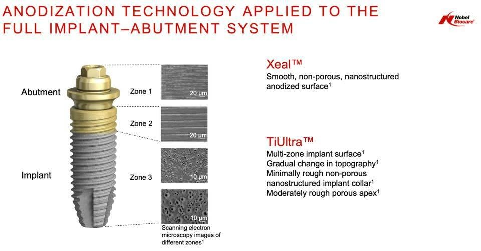 TiUltra 與 Xeal 植體系統說明